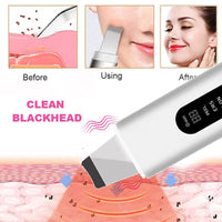 Thumbnail for GlowEase™ Skin Scrubber - Your Path to Flawless Skin!